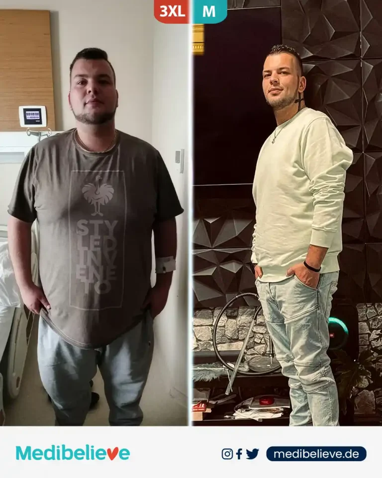 before-after-lp-13