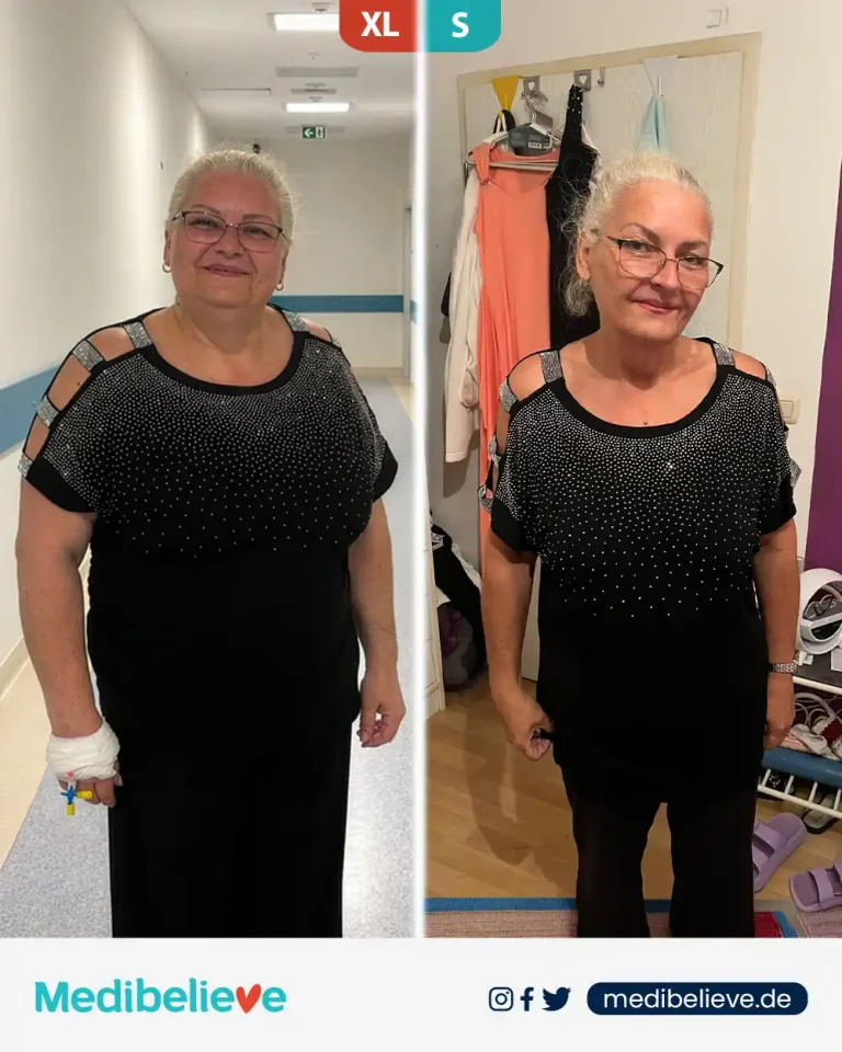 before-after-lp-2