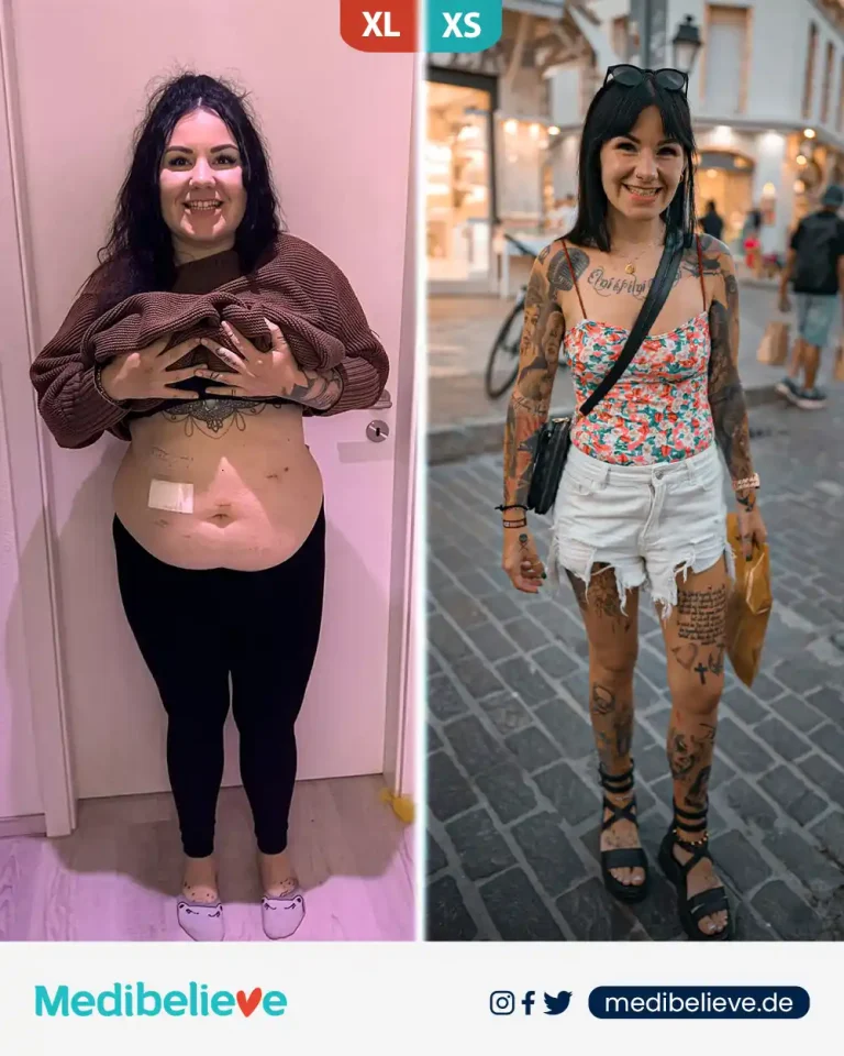 before-after-lp-5