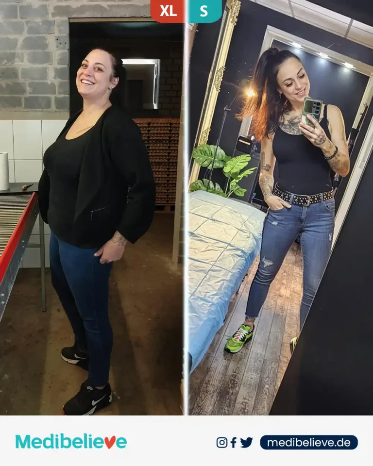 before-after-lp-6